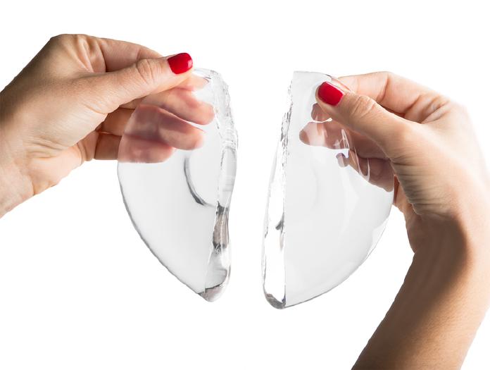Another demonstration of a Round MemoryGel® silicone breast implant (also known as the “gummy bear” breast implant) cut in half.